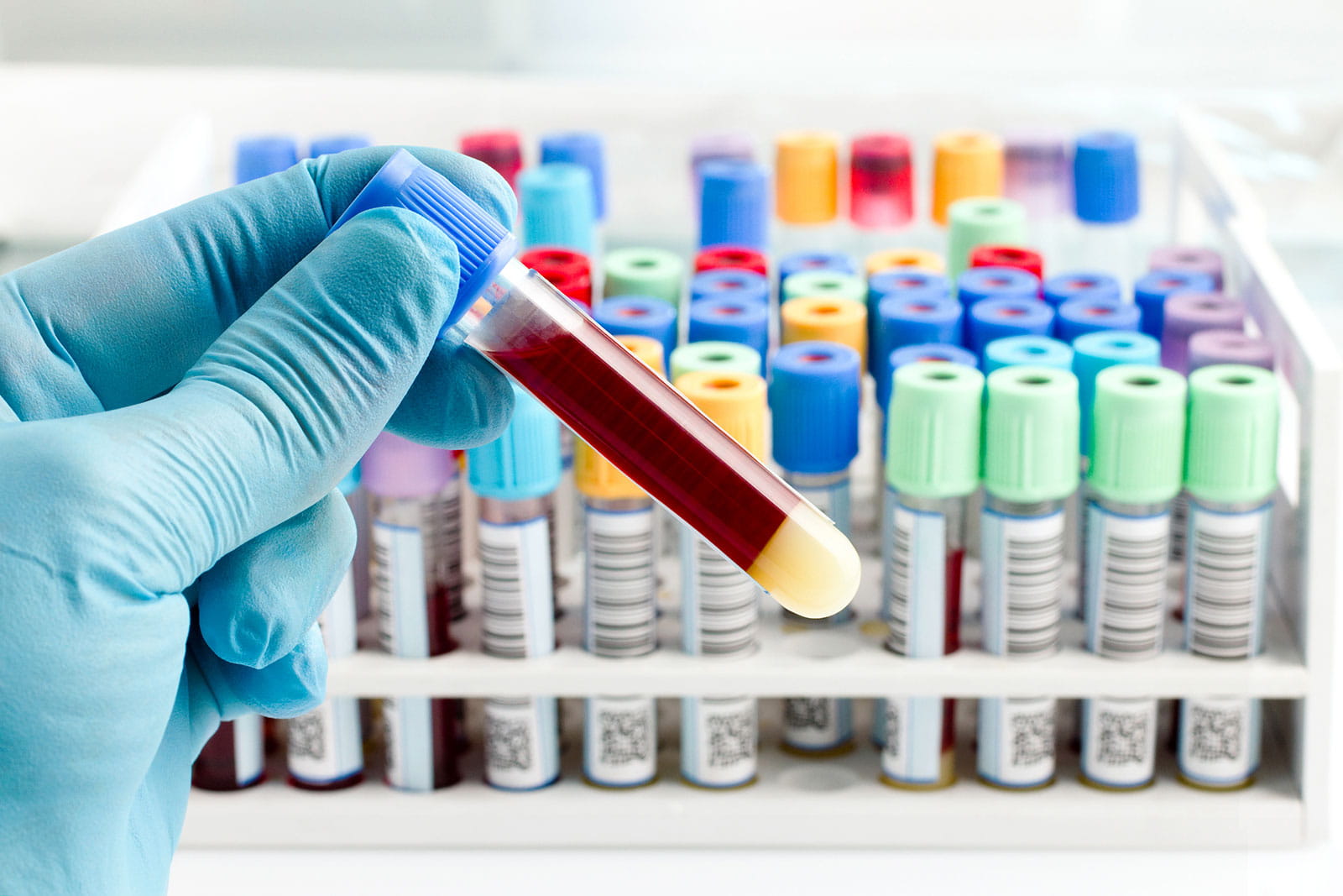 Gloved hand holding blood sample